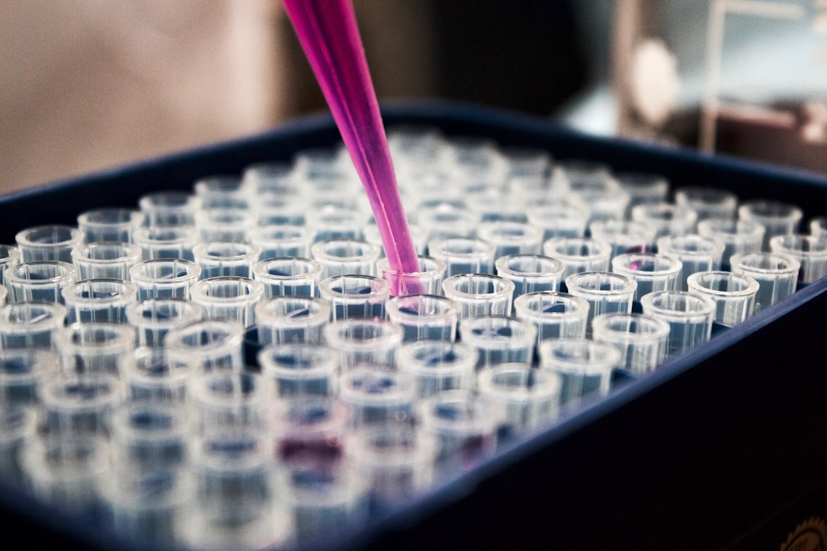Methylene blue drug test: laboratory test tubes and urine sample for screening