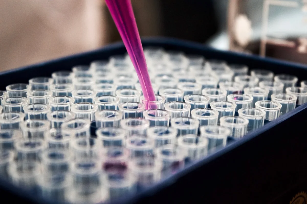 Methylene blue drug test: laboratory test tubes and urine sample for screening