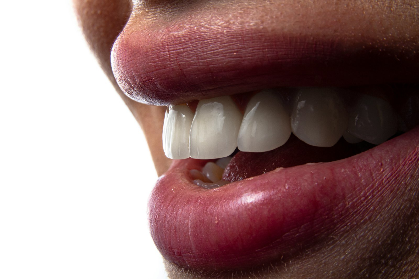 Close-up of healthy white teeth — does methylene blue stain teeth, explained